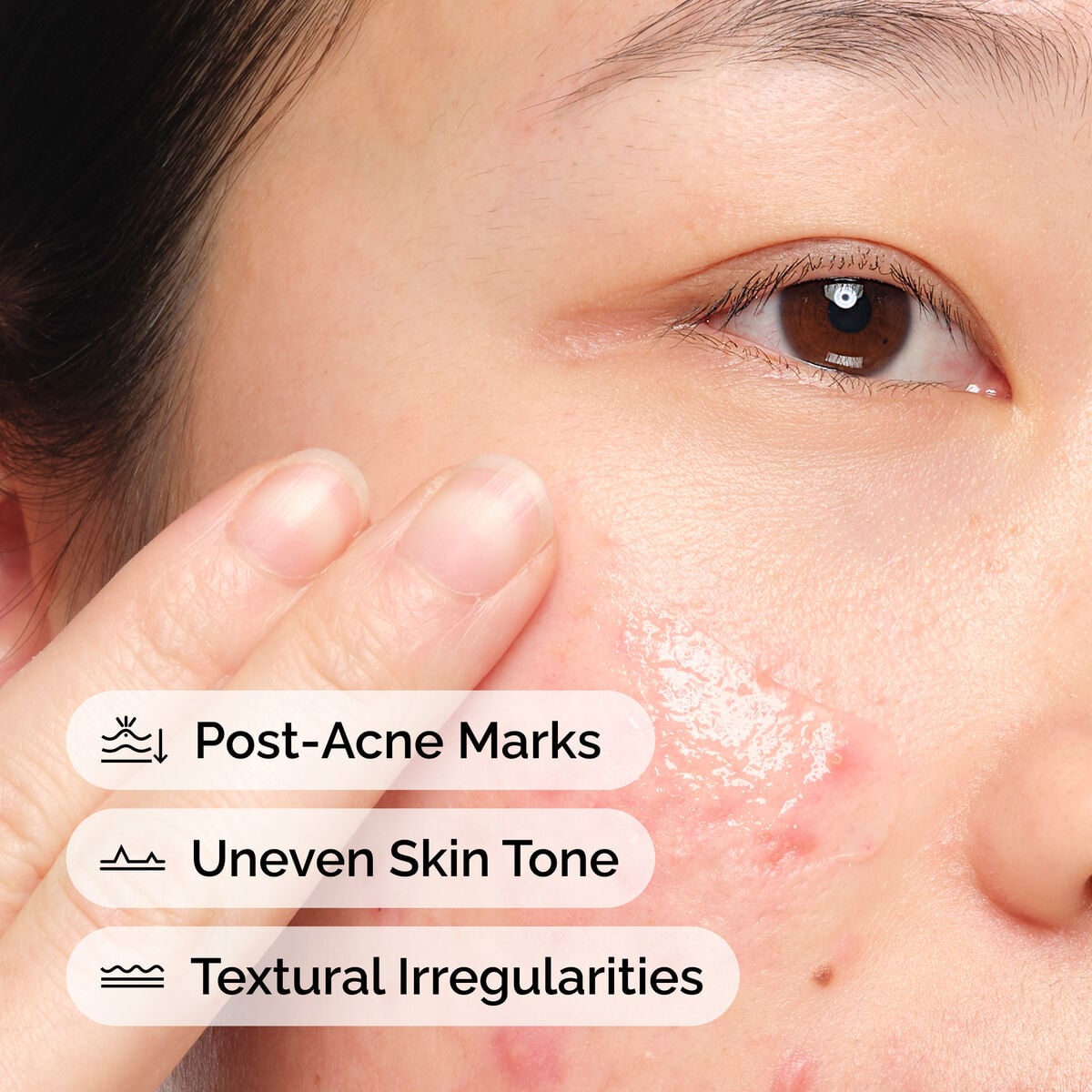Aloe + NAG Solution Targeted Serum Care B5