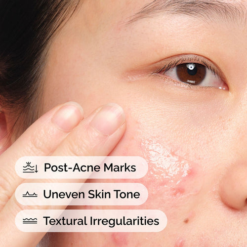 Aloe + NAG Solution Targeted Serum Care B5