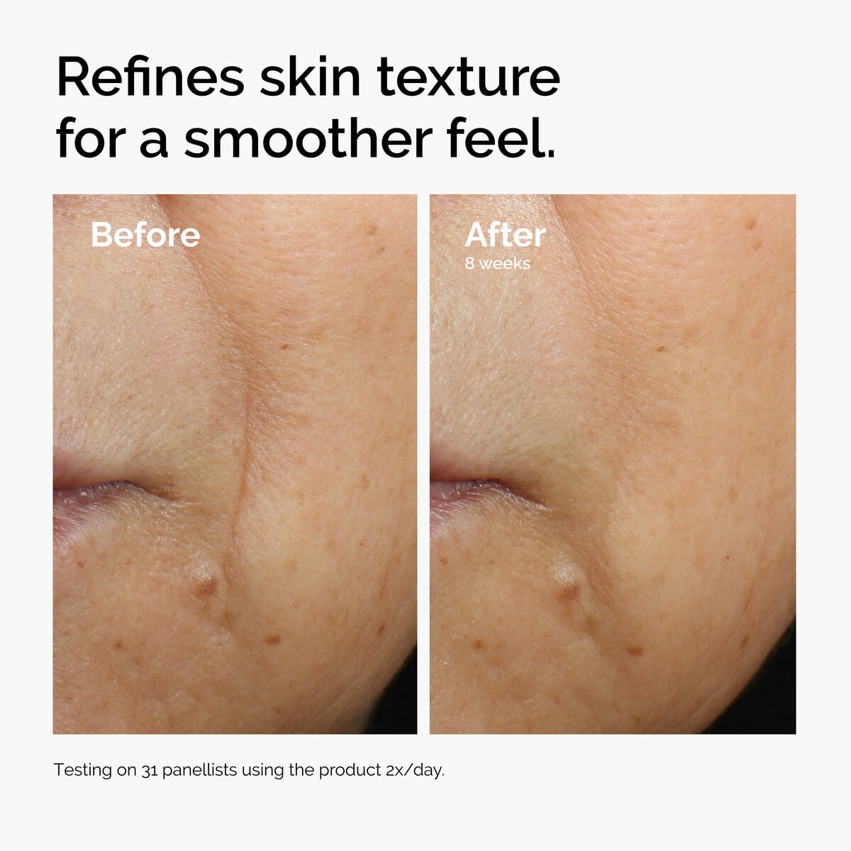 Caffeine + Escin Face Serum Targeted Serum Care R3