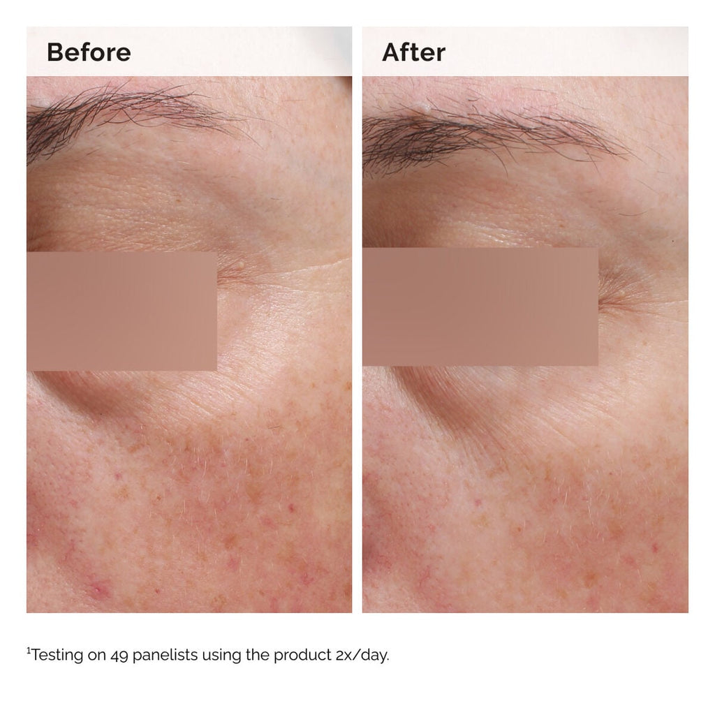 Niacinamide Face and Body Emulsion Targeted Serum Care X5