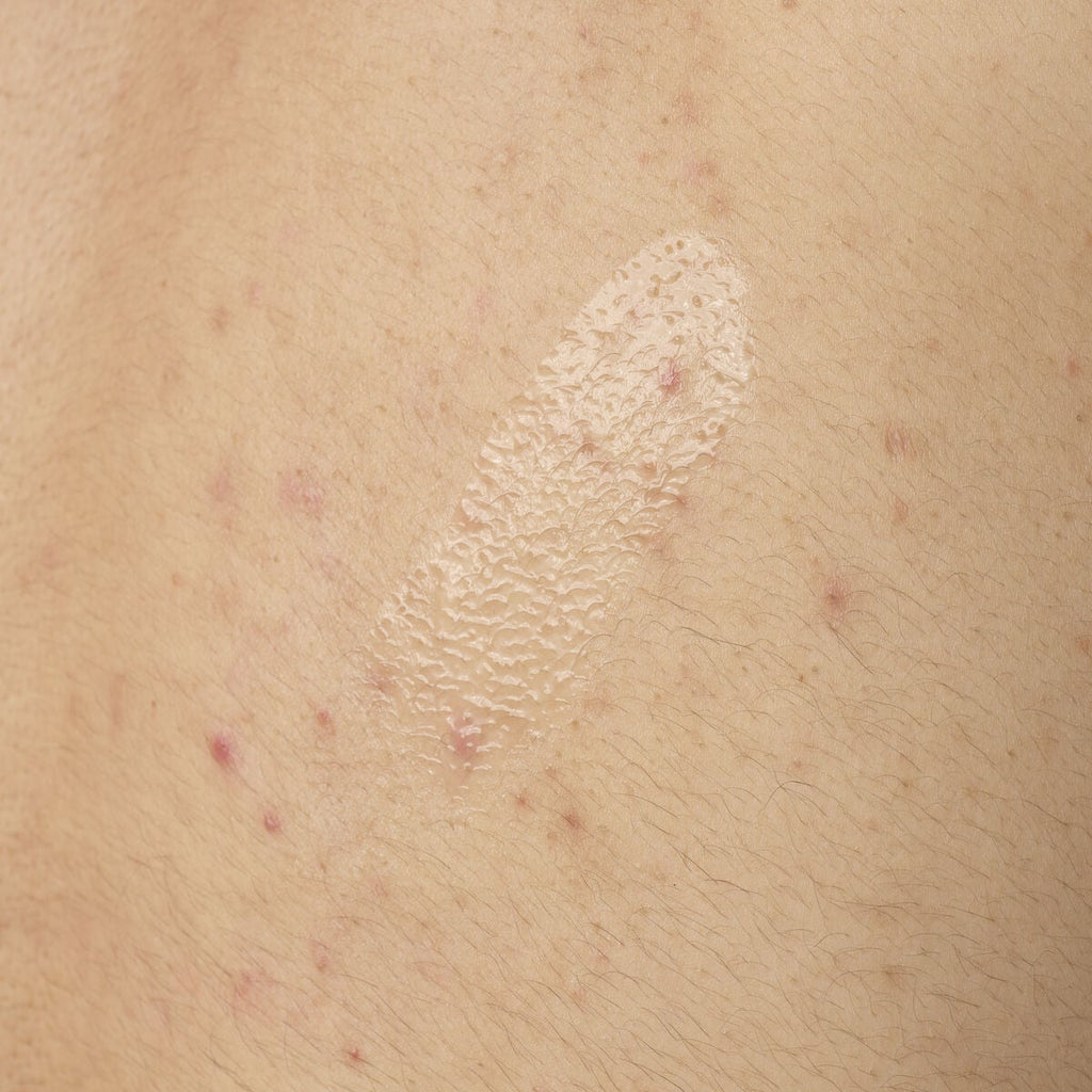 Salicylic Acid Body Serum Targeted Serum Care Q3