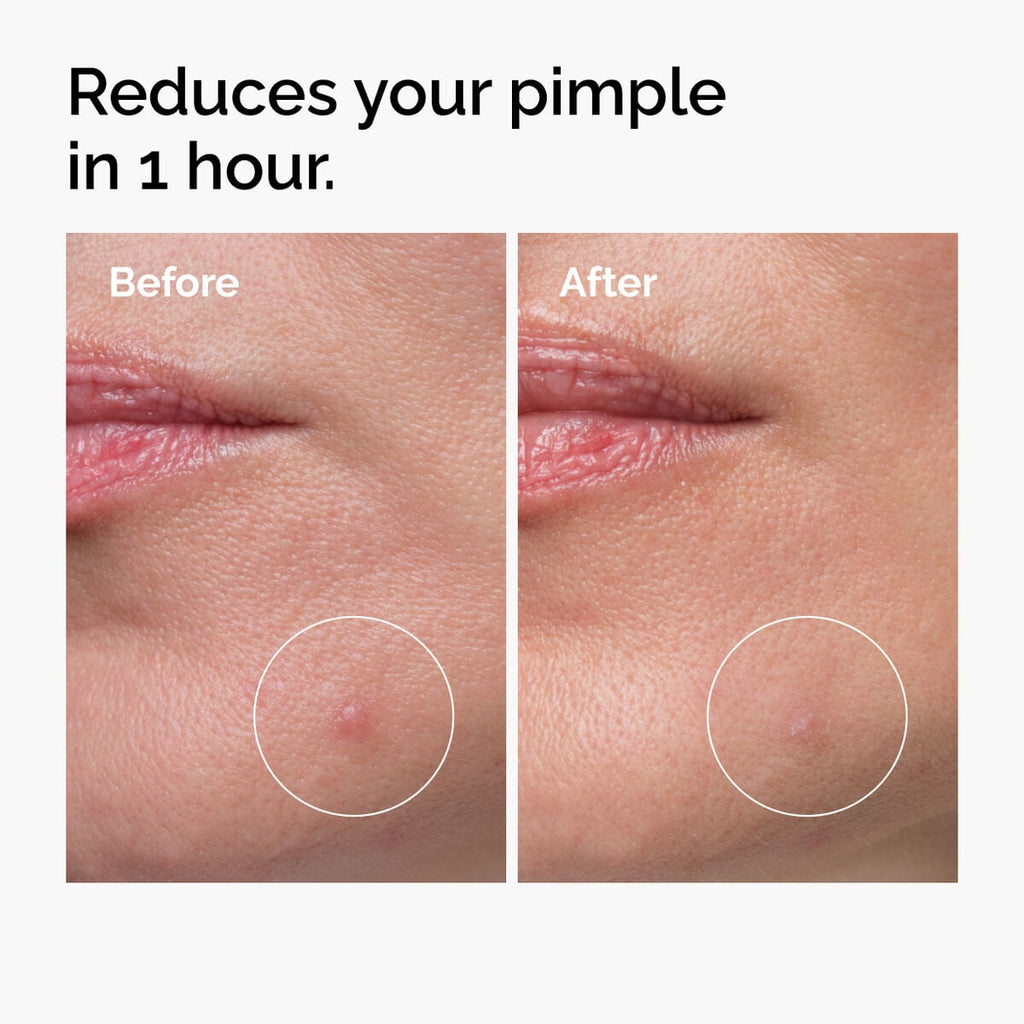 Sulfur Powder-to-Cream Concentrate Targeted Serum Care B1